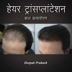 HAIR TRANSPLANTATION by deepak prakash in Hindi