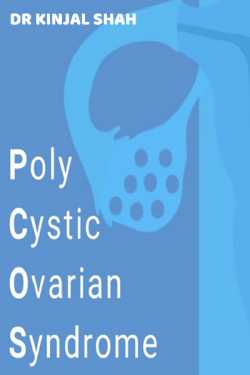 Polycystic Ovarian Syndrome by Dr Kinjal Shah in English