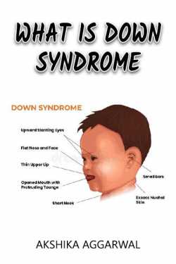 What is  Down syndrome by Akshika Aggarwal in English