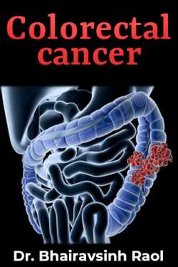 Colorectal cancer by Dr. Bhairavsinh Raol in English
