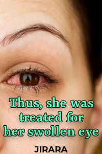 Thus, she was treated for her swollen eye