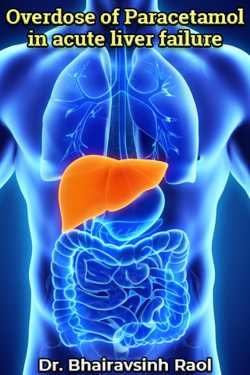 Overdose of Paracetamol in acute liver failure by Dr. Bhairavsinh Raol in English