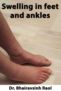 Swelling in feet and ankles