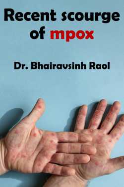 Recent scourge of mpox by Dr. Bhairavsinh Raol