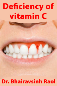 Deficiency of vitamin C