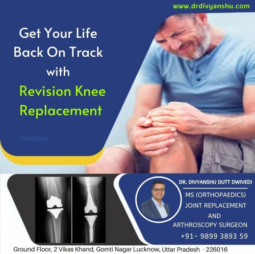 Post by Best Orthopedic Surgeon Doctor In Lucknow on 06-Aug-2022 03:04pm