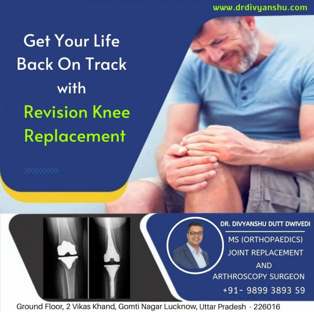 English Blog by Best Orthopedic Surgeon Doctor In Lucknow : 111823913