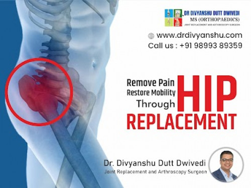 Post by Best Orthopedic Surgeon Doctor In Lucknow on 17-Oct-2022 01:57pm