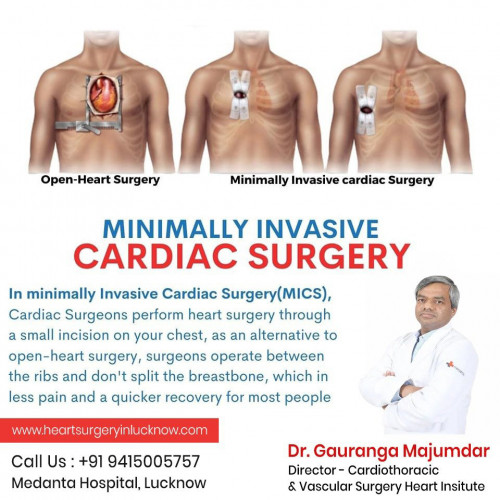 Post by Best Heart Bypass Surgery Dr Gauranga Majumdar on 28-Jun-2023 11:13am