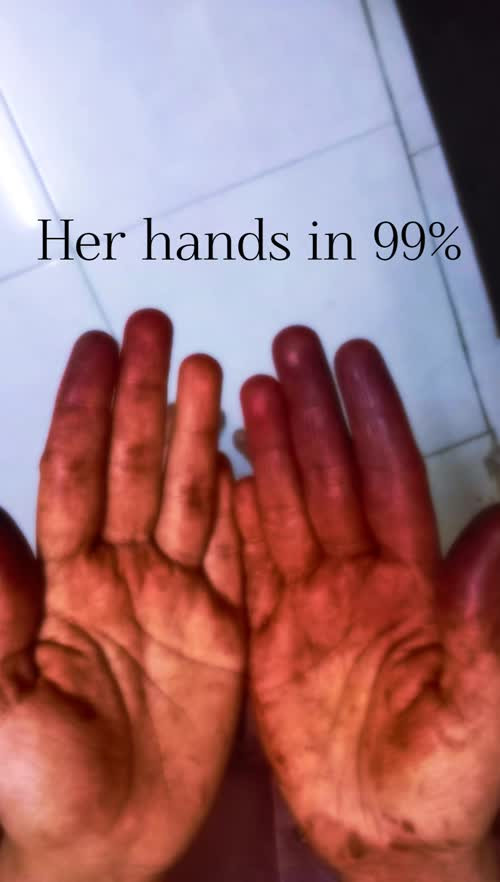 epost thumb