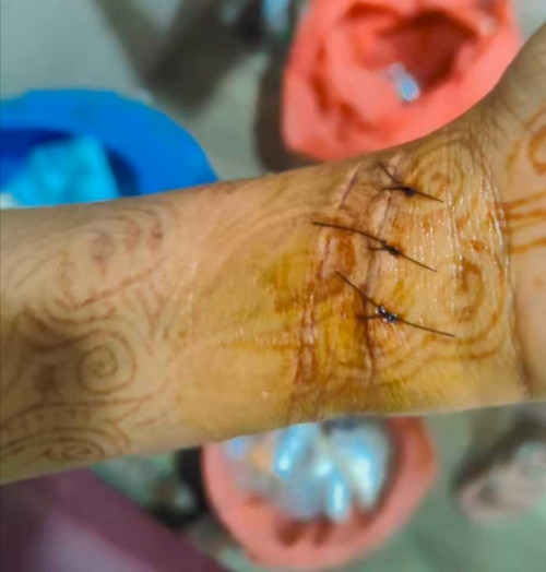 Post by Hetu P on 09-May-2025 10:17am