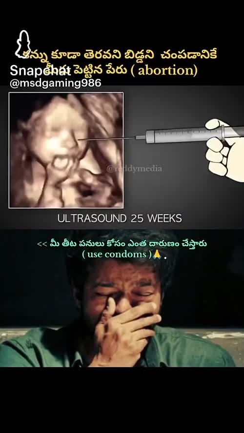 epost thumb